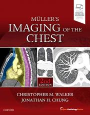 Muller's Imaging of the Chest : Expert Radiology Series 2nd