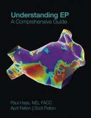 Understanding EP: a Comprehensive Guide : Part 1 Of 2