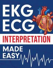 EKG Study Guide 