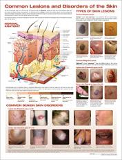 Common Lesions and Disorders of the Skin Anatomical Chart 